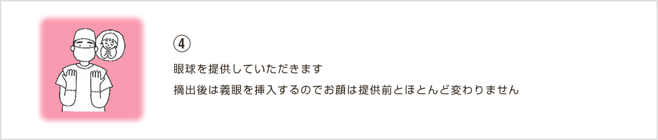 ④眼球を提供していただきます摘出後は義眼を挿入 するのでお顔は提供前とほとんど変わりません